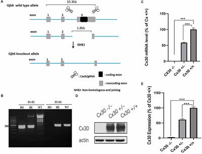 Connexin30-Deficiency Causes Mild Hearing Loss With the Reduction of Endocochlear Potential and ATP Release